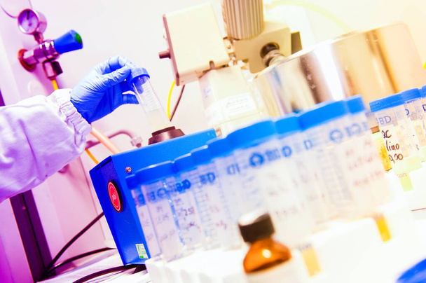 επιστήμονας που αναλύει τον ιό στο εργαστήριο covid 19 αίμα και χημικό σωλήνα αντιδραστηρίου στο χέρι έρευνα εμβόλιο coronavirus  - Φωτογραφία, εικόνα