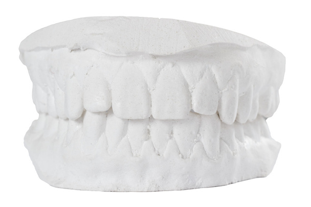 Οδοντιατρική γύψου μοντέλο καλούπι των δοντιών σε γύψο απομονωθεί σε λευκό φόντο - Φωτογραφία, εικόνα