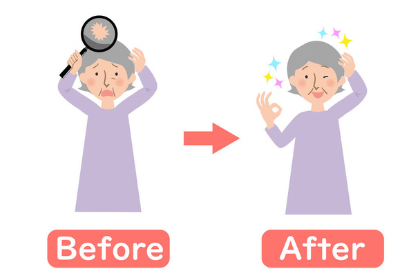 Před-po vektorové ilustrace babičky trpí řídnoucí vlasy na hlavě -Orientální babička s šedivými vlasy - Vektor, obrázek