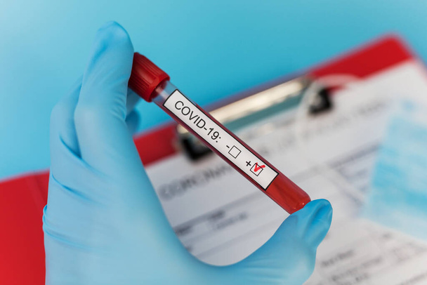 Blood result tube in doctor hand mers cov coronavirus test positive label in hospital. New rapidly spreading Coronavirus, world pandemic. - Photo, Image