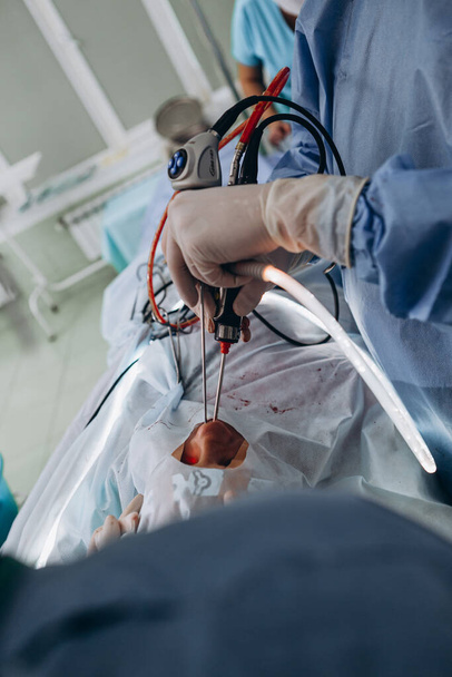03.09.2019 Vinnitsa, Ukraine: Surgeon wearing medical mask with medical team performing surgery in hospital operation theater - Fotó, kép