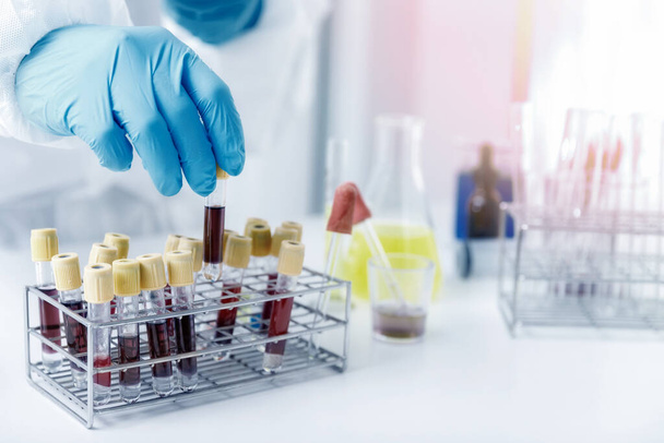 I ricercatori esaminano i campioni di sangue in laboratorio. I ricercatori stanno inventando vaccini per il trattamento del virus COVID-19. - Foto, immagini