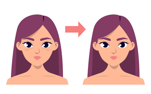 Blefaroplastia antes y después del aislamiento del vector. Operación médica, modificación facial femenina. Cirugía plástica en el párpado. Deshazte de las arrugas
. - Vector, imagen