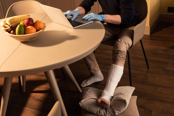 Vue recadrée de l'homme avec bandage en plâtre sur la jambe et des gants en latex à l'aide d'un ordinateur portable sur la table dans la cuisine
  - Photo, image