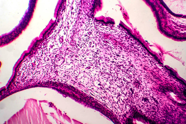 Ovarian mucinous cystadenoma, a benign tumor of ovary, light micrograph, photo under microscope - Фото, зображення