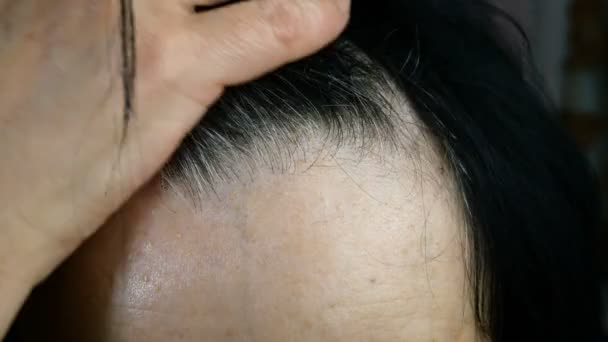 Mujer adulta madura se quita el pelo de la frente. Cabello gris, alopecia y piel problemática en la cabeza. Primer plano
. - Metraje, vídeo