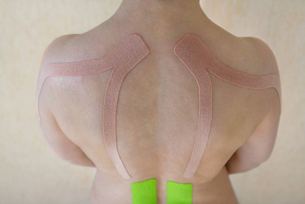 Special physio tape on the back of a young woman, muscle rehabilitation - Valokuva, kuva