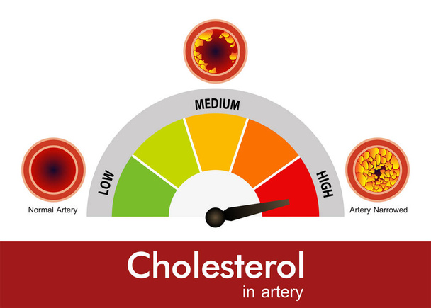 Cholesterol in artery, health risk , vector design - Vector, Image