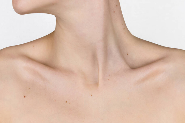 necklace of moles, moles on the neck, collarbone and breast of a young girl, concept of skin care, beauty and risks of papillomavirus cancer - Фото, изображение