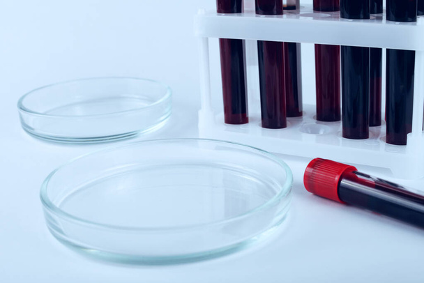 Petri edény és üveg csepegtető egy laboratóriumi padon, tónusos kék színű - Fotó, kép
