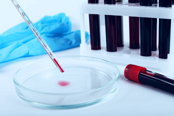 placa de Petri e conta-gotas de vidro em um banco de laboratório, tonificado cor azul
 - Foto, Imagem