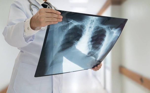 Médecin examinant la radiographie pulmonaire du patient à l'hôpital
. - Photo, image