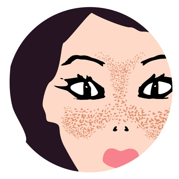 Sproeten op het gezicht. Pigmentatie op de huid. Een gepigmenteerde vlek op de huid van het gezicht. Vectorillustratie - Vector, afbeelding