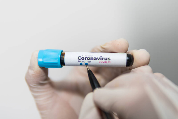 Test tube with a blood sample for a test for antibodies to coronavirus in the hands of a laboratory assistant in gloves, writes a negative sign a pen, isolated on white, closeup. Covid-19 concept. - Foto, Imagen