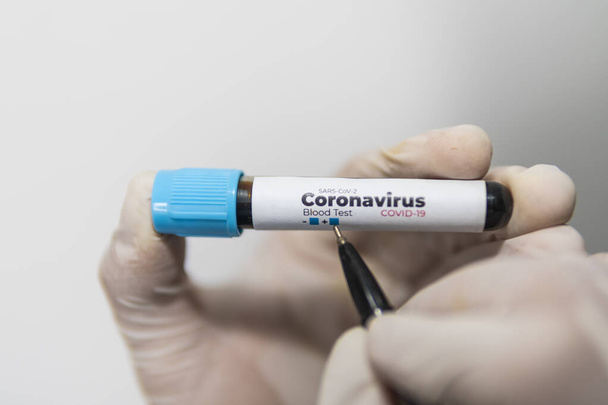 Tubo de prueba con una muestra de sangre para una prueba de anticuerpos contra el coronavirus en las manos de un asistente de laboratorio en guantes, escribe un signo negativo una pluma, aislado en blanco, primer plano. Concepto Covid-19
. - Foto, Imagen