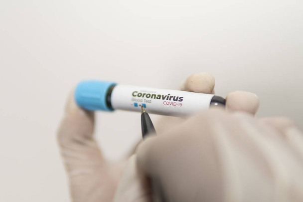 Test tube with a blood sample for a test for antibodies to coronavirus in the hands of a laboratory assistant in gloves, writes a negative sign a pen, isolated on white, closeup. Covid-19 concept. - Foto, Imagen