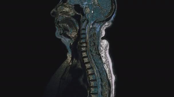 Pooperační mnohobarevná MRI ženských orgánů pro detekci metastáz - Záběry, video