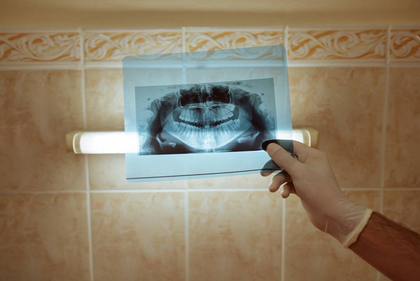 Młody biały dentysta w masce patrzy na prześwietlenie zębów w gabinecie dentystycznym. - Zdjęcie, obraz