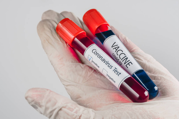 Vakuumröhrchen mit einer Blutprobe mit einem positiven Ergebnis auf Covid-19-Infektion und einer Probe von Impfstoff blauer Farbe in der Hand mit einem medizinischen Handschuh auf weißem Hintergrund - Foto, Bild