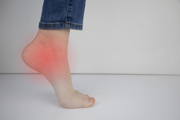 Woman suffering from heel pain. Inflammation or sprain of the tendon in the foot, heel spur, bursitis. The concept of diseases and pains in the leg - Photo, Image
