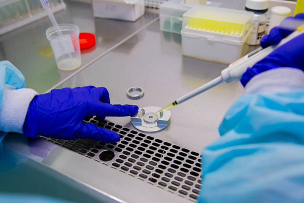 Laboratorio de fertilización in vitro biotecnología análisis de espermatozoides
 - Foto, Imagen
