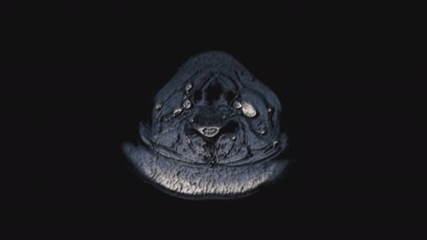 Pooperacyjny tomowy kolor MRI narządów żeńskich do wykrywania przerzutów - Materiał filmowy, wideo
