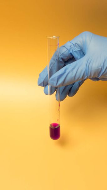 A hand with a blue glove holds in a test tube samples of coronavirus COVID-19 . Concept on a yellow background - Photo, image