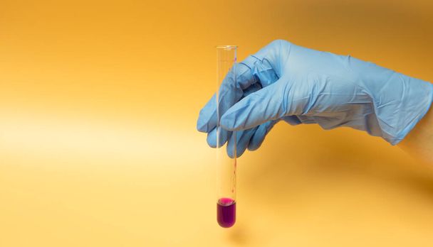Una mano con un guante azul sostiene en una probeta muestras de coronavirus COVID-19. Concepto sobre fondo amarillo
 - Foto, Imagen