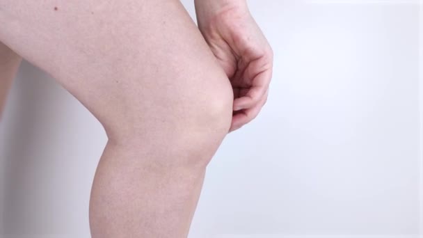 A woman suffers from knee pain. Examination by an orthopedist and traumatologist. Redness and swelling of the legs, torn meniscus or knee bursitis - Footage, Video