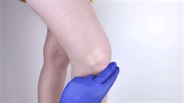 Žena trpí bolestí kolena. Vyšetření ortopedem a traumatologem. Zčervenání a otok nohou, roztržený meniskus nebo kolenní bursitida - Záběry, video