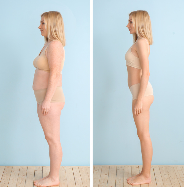 Νεαρή γυναίκα πριν και μετά την απώλεια βάρους στο φόντο χρώμα - Φωτογραφία, εικόνα