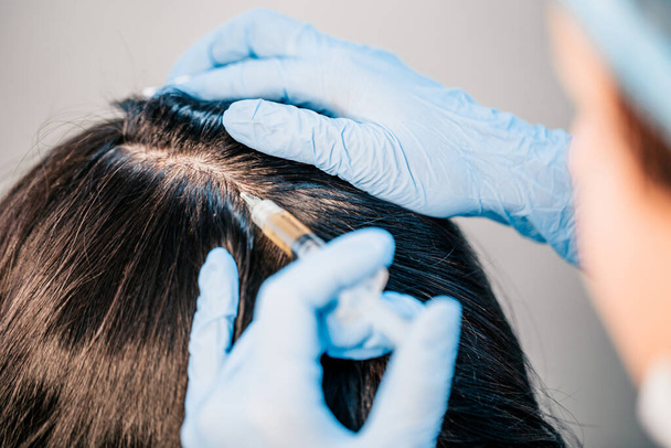 Plasmolifting of the scalp - in the case of the initial stages of baldness and to improve the condition of the hair - Photo, image