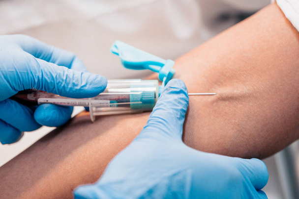 Plasma lifting - blood sampling from a vein to separate plasma in a centrifuge - 写真・画像