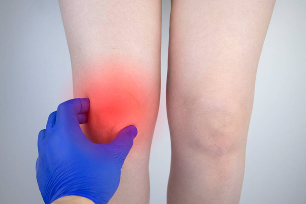 女性は膝の痛みに苦しんでいます。整形外科医と外傷科医による検査。足の発赤と腫れ,引き裂かれたメニスカスや膝関節炎 - 写真・画像