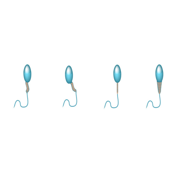 A sperma kóros formái az ejakulátumban. Férfi meddőség Oligospermia. Spermogram. A fej patológiája. Sperma rendellenességek. Infografikák. Vektorillusztráció izolált háttérrel. - Vektor, kép