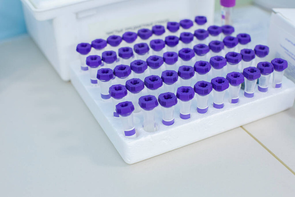 tubos de ensaio de laboratório médico azul na mesa
 - Foto, Imagem