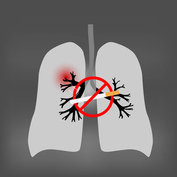 Journée mondiale sans tabac. Fumer causant le cancer du poumon
 - Vecteur, image