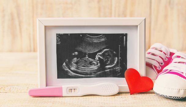 Bebeğin fotoğrafının ve aksesuarlarının ultrason fotoğrafı. Seçici odaklanma. çocuk. - Fotoğraf, Görsel