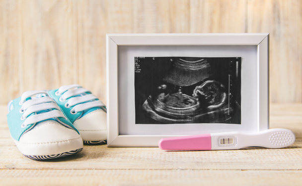 Ultrasound picture of a baby's photograph and accessories. Selective focus. child. - 写真・画像