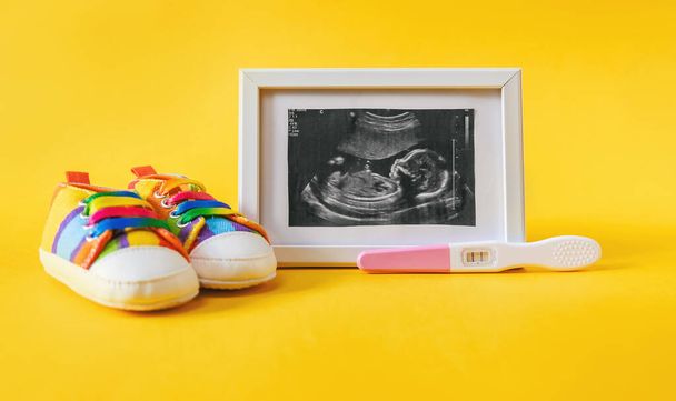 Ultrasound picture of a baby's photograph and accessories. Selective focus. child. - Φωτογραφία, εικόνα