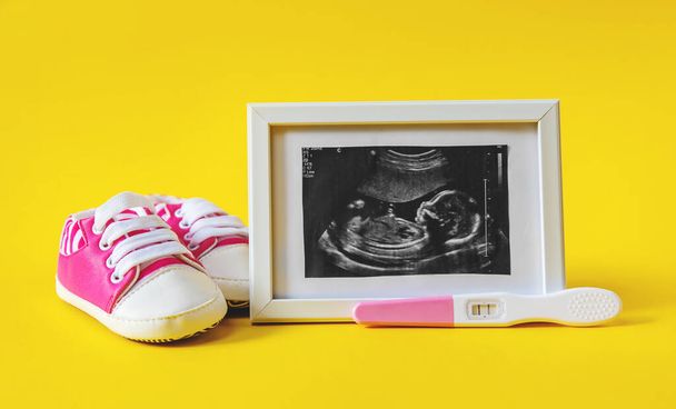 Ultrahangos kép a baba fényképéről és tartozékairól. Szelektív fókusz. gyermek. - Fotó, kép