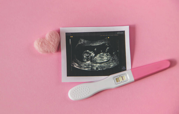 Bebeğin fotoğrafının ve aksesuarlarının ultrason fotoğrafı. Seçici odaklanma. çocuk. - Fotoğraf, Görsel