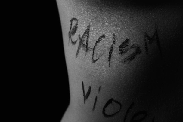 část těla mladé dívky se slovy "rasismus". Nápisy jsou napsány rukou fotografa, ne tetováním. černobílá fotografie. - Fotografie, Obrázek
