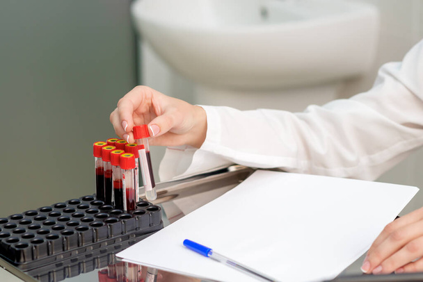 Hand des Arztes nimmt Reagenzglas mit Blut aus Tablett auf Tisch im Labor. - Foto, Bild