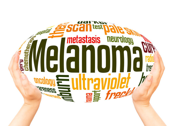 Melanoma - palabra cáncer de piel esfera de mano nube concepto sobre fondo blanco
.  - Foto, Imagen
