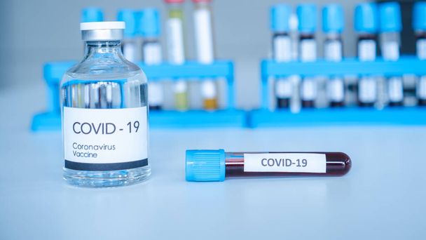 Het Corona Virus Vaccine wordt in een medisch laboratorium op het bureau van een wetenschapper geplaatst. Wetenschappers werken aan een vaccin om patiënten met opkomende infectieziekten te behandelen. - Foto, afbeelding