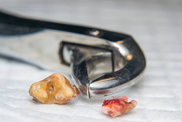 onttrokken hond tanden en extractie tang close-up - Foto, afbeelding