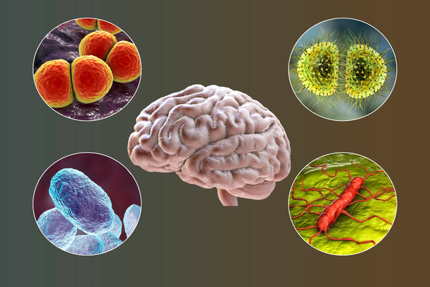 Eziologia della meningite batterica, illustrazione 3D. Neisseria meningitidis, Streptococcus pneumoniae, Haemophilus influenzae e Listeria monocytogenes batteri
 - Foto, immagini