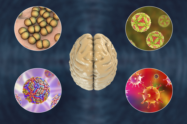 Інфекції мозку, мікроорганізми, які викликають енцефаліт і менінгіт
 - Фото, зображення