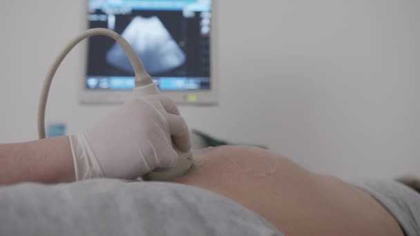 Dokter maken doet echografie, Sonogram procedure voor een zwangere vrouw. Een close-up. 6k. - Video